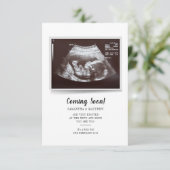 Bald wird Skript Ultrasound Foto Schwangerschaft (Stehend Vorderseite)