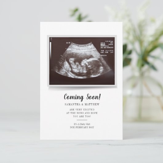 Bald wird Skript Ultrasound Foto Schwangerschaft (Stehend Vorderseite)