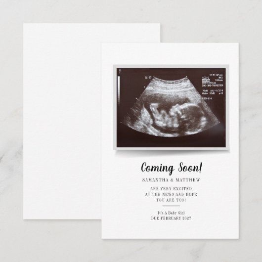 Bald wird Skript Ultrasound Foto Schwangerschaft (Vorne/Hinten)