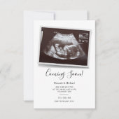 Bald wird Sonogram Pregnancy Ankündigung (Vorderseite)