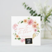 Bald zu drei Ergebnissen bei Ultraschallschwangers Ankündigung (Stehend Vorderseite)