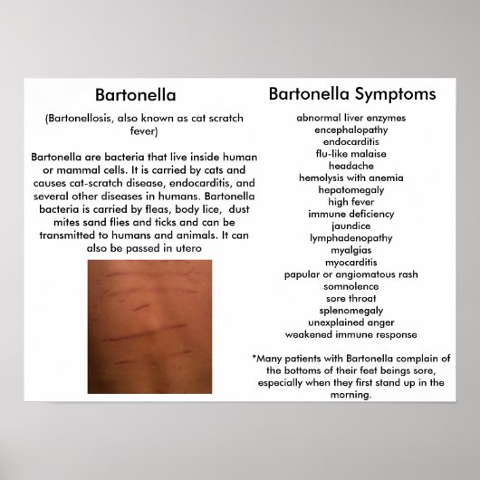Bartonella Symptome Lernposter Poster (Vorne)