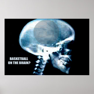 Basketballkopf (Röntgen) Poster
