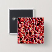 BEACH PEBBBLES BUTTON (Vorne & Hinten)