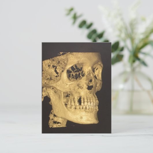 Beängstigender Schädel Postkarte (Stehend Vorderseite)