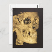 Beängstigender Schädel Postkarte (Vorne/Hinten)
