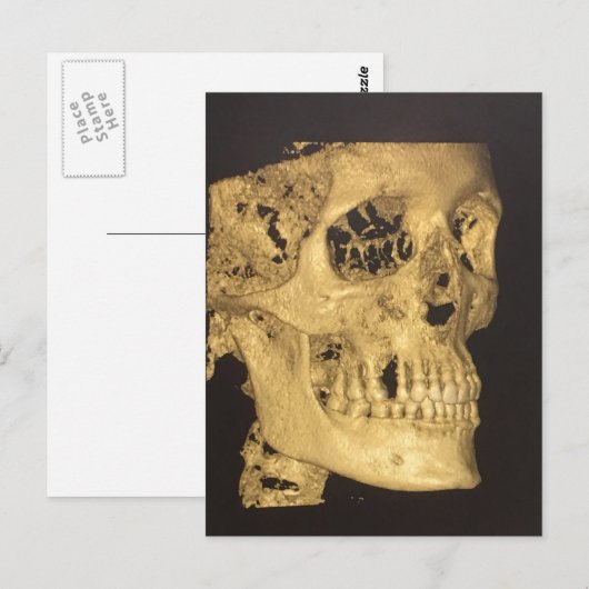 Beängstigender Schädel Postkarte (Vorne/Hinten)