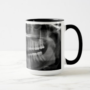 Becher Panorama Röntgenaufnahme Tasse