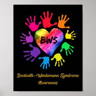 Beckwith Wiedemann Syndrome Awareness Hands Gesche Poster