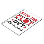Beenden Sie die DVT Clot Sensibilisierung für tief Notizblock (Linke Seite)