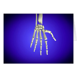Begriffsbild der Knochen in menschlicher Hand 2