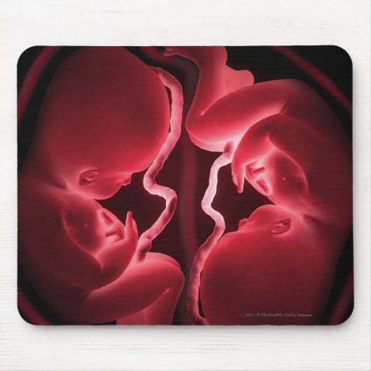 Begriffsbild einer Geb5rmutter, die Zwillinge Mousepad (Vorne)
