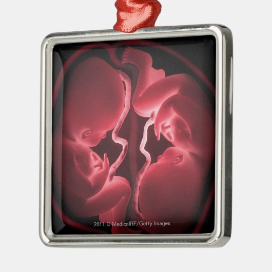 Begriffsbild einer Geb5rmutter, die Zwillinge Ornament Aus Metall (Links)