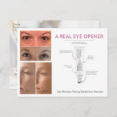 Behandlung des Jugenauges Postkarte (Vorne/Hinten)