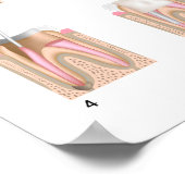 Behandlung des Root Canal Jede Größe Poster (Ecke)