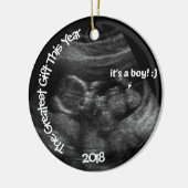 Benutzerdefinierte LEASY-Ultraschallvorlage Keramik Ornament (Links)