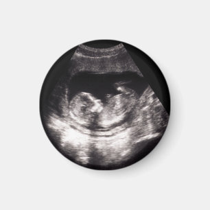 Benutzerdefiniertes Baby-Ultraschall-Schwangerscha Magnet