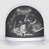 Benutzerdefiniertes Sonogramm Schwangerschaft Ultr Schneekugeln (Vorderseite)
