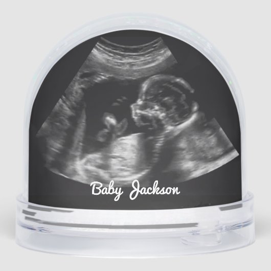 Benutzerdefiniertes Sonogramm Schwangerschaft Ultr Schneekugeln (Rückseite)