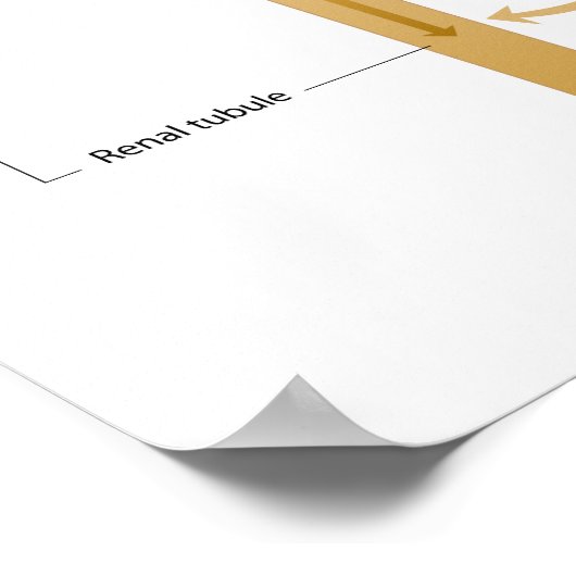 Bildung des Harnposters Poster (Ecke)