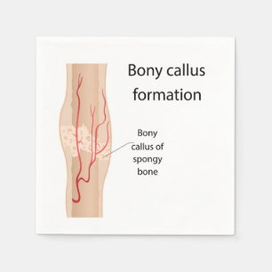 Bildung von Bony callus Serviette