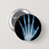 Blaue Röntgenstrahl-Skelett-Hand Button (Vorne & Hinten)