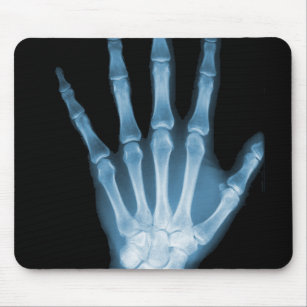 Blaue Röntgenstrahl-Skelett-Hand Mousepad