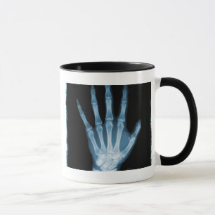 Blaue Röntgenstrahl-Skelett-Hand Tasse