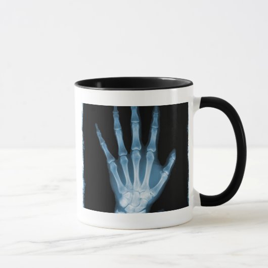 Blaue Röntgenstrahl-Skelett-Hand Tasse (Rechts)