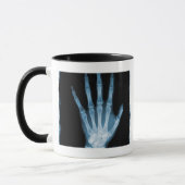 Blaue Röntgenstrahl-Skelett-Hand Tasse (Links)
