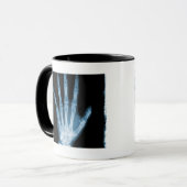 Blaue Röntgenstrahl-Skelett-Hand Tasse (Vorderseite Links)