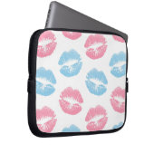 Blaue und rosa Lippenmuster, Lipstick, Kiss Laptopschutzhülle (Vorne Rechts)
