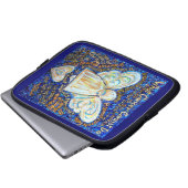Blue Gold Cancer kann den Computer Sleeve Bag nich (Vorne Knopf)