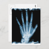 Blue Röntgen Skeleton Hand Postkarte (Vorne/Hinten)