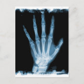 Blue Röntgen Skeleton Hand Postkarte (Vorderseite)