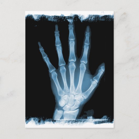 Blue Röntgen Skeleton Hand Postkarte (Vorderseite)