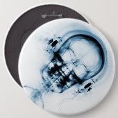 Blue X-Ray Vision Music Skeleton Skull Button (Vorne & Hinten)