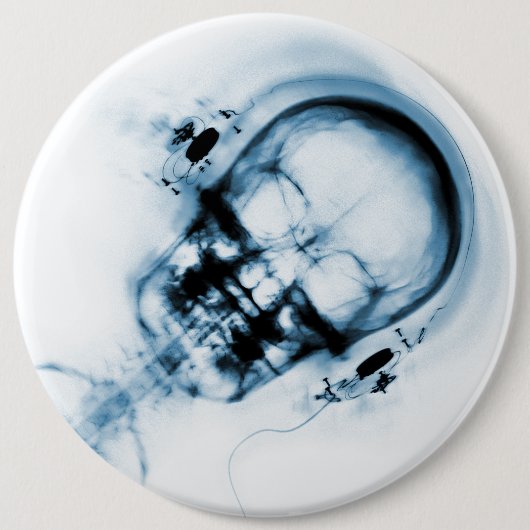 Blue X-Ray Vision Music Skeleton Skull Button (Vorderseite)