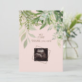 Blush Ultrasound Girl Funny Baby Dusche Vielen Dan Dankeskarte (Stehend Vorderseite)