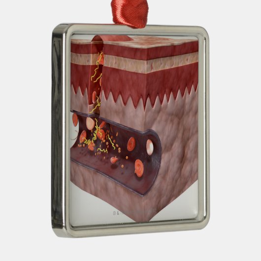 Blutgerinsel-Bildung Silbernes Ornament (Rechts)