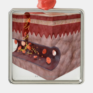Blutgerinsel-Bildung Silbernes Ornament