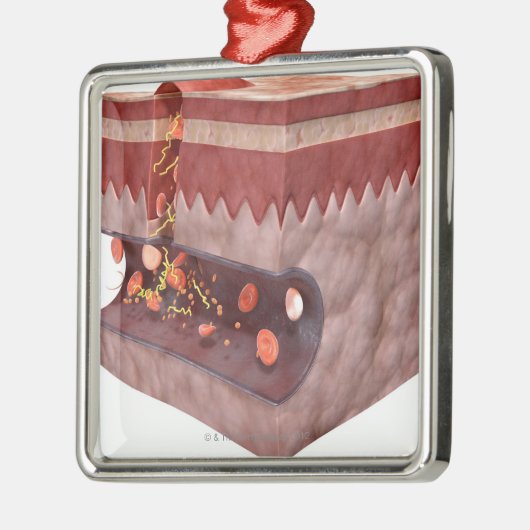 Blutgerinsel-Bildung Silbernes Ornament (Links)