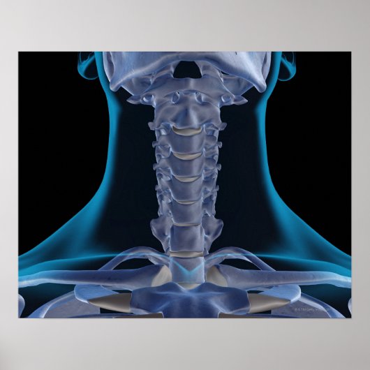 Bones of the Neck 2 Poster (Vorne)