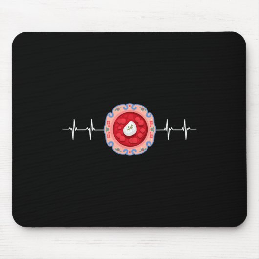 Borschtsch Rote-Bete Ukrainischer Borschtsch 4 Mousepad (Vorne)
