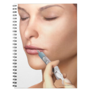 Botox Injektionen Notizblock