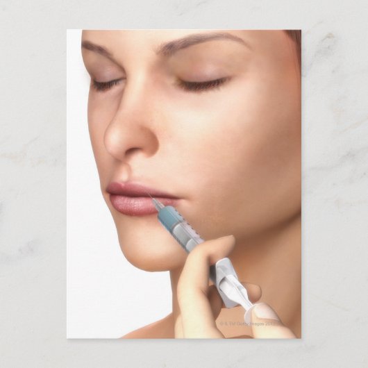 Botox Injektionen Postkarte (Vorderseite)
