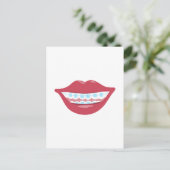 Braces Smile Postkarte (Stehend Vorderseite)