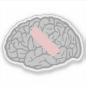 Brain-Ache Aufkleber (Vorderseite)