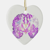 Brain Keramik Ornament (Rechts)