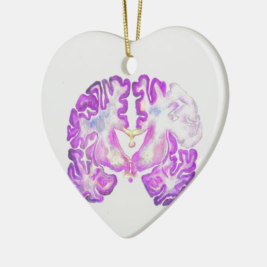 Brain Keramik Ornament (Links)